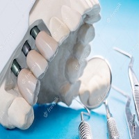 зъбни импланти цена - 61297 комбинации